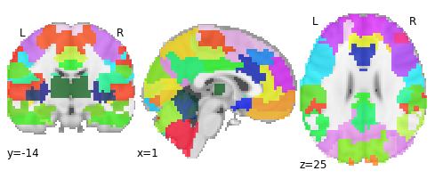 ../_images/Predicting_age_with_machine_learning_14_1.png