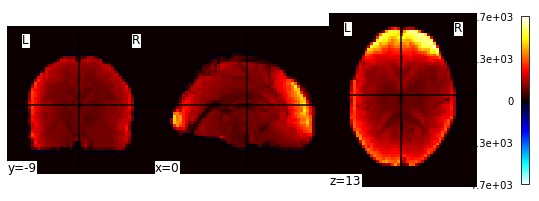 ../_images/Predicting_age_with_machine_learning_18_1.png