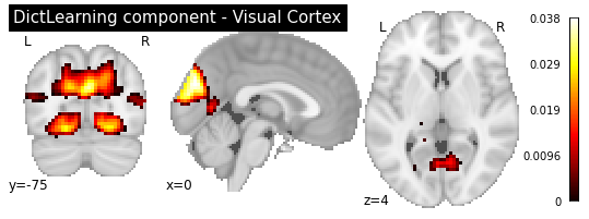 ../_images/functional_connectivity_100_2.png