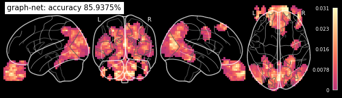 ../_images/machine_learning_nilearn_56_1.png