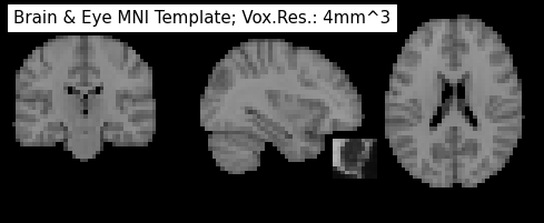 ../_images/machine_learning_preparation_15_1.png