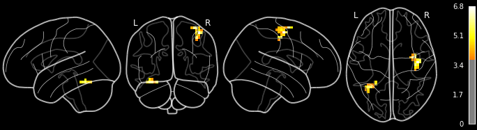 ../_images/statistical_analyses_MRI_68_0.png