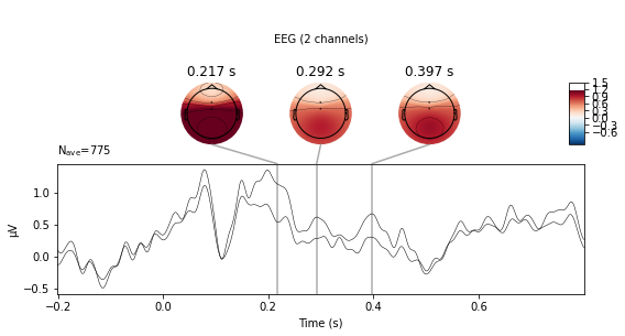 ../_images/mne_workflow_tutorial_121_1.png